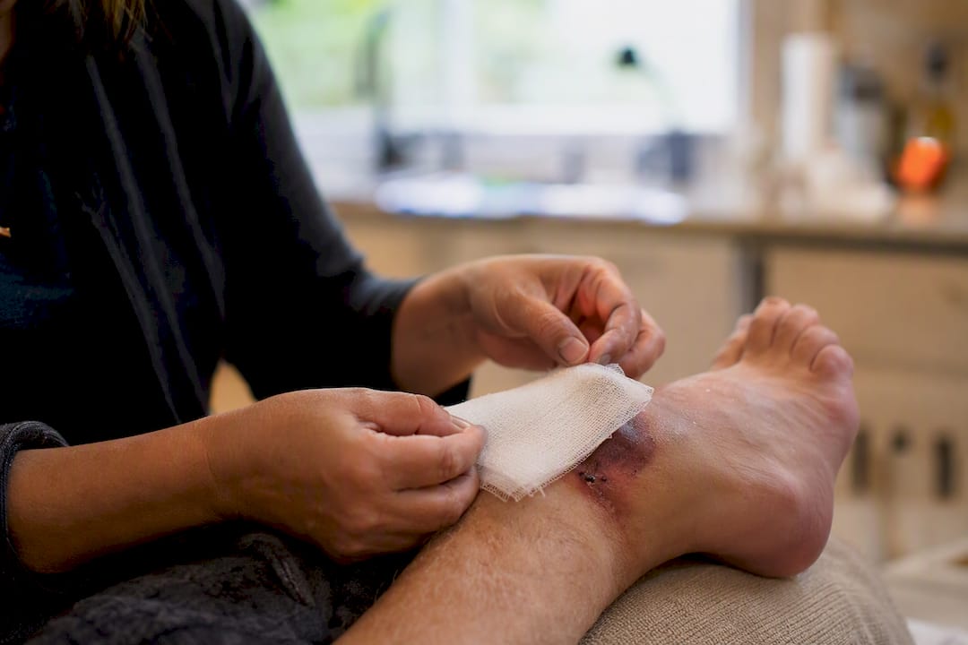 Hands changing wound dressing with antiseptic