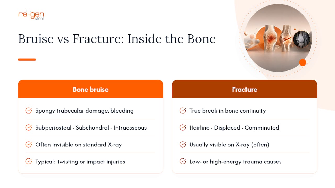 Bone Bruise vs Fracture: What's Actually Happening Inside the Bone — overview diagram