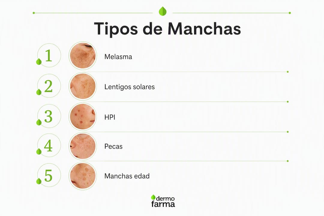 Infografía que explica los tipos más frecuentes de manchas en la piel, acompañada de un listado de pasos para identificarlas y tratarlas.