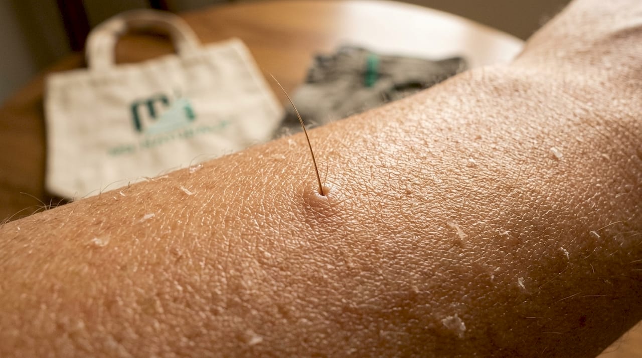 Close-up of clear skin with healthy hair follicle