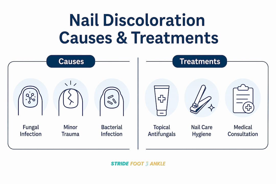Infographic with causes and treatments of nail discoloration