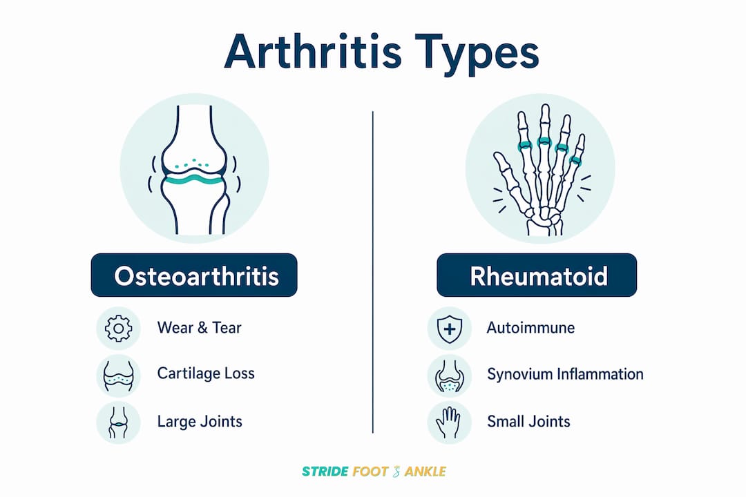 Infographic comparing osteoarthritis and rheumatoid arthritis