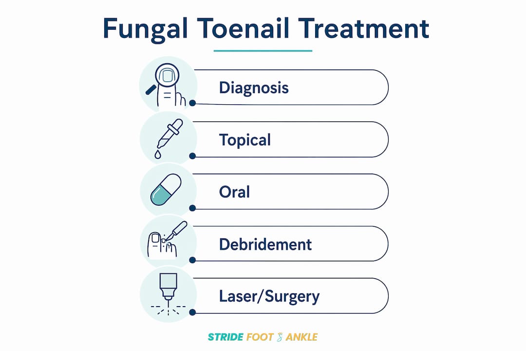 Infographic displaying fungal toenail treatment steps