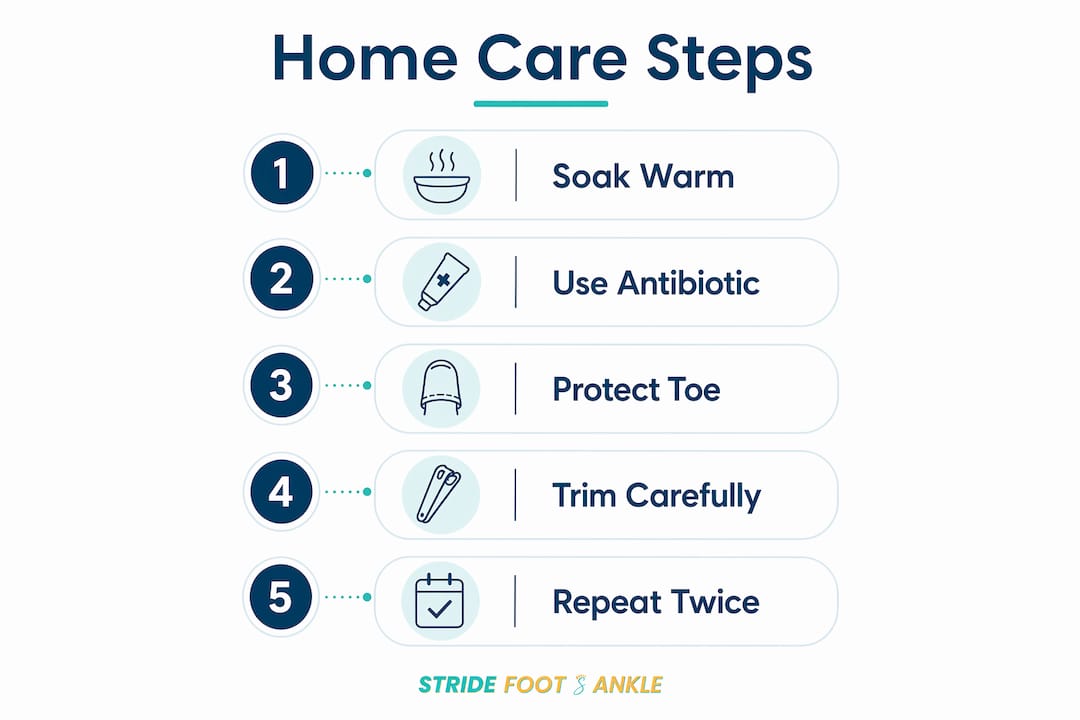 Infographic illustrating home care steps for ingrown toenails