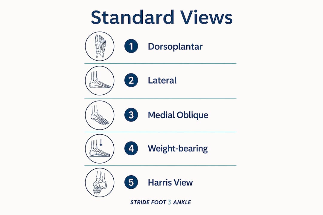 Infographic showing standard pediatric foot x-ray views