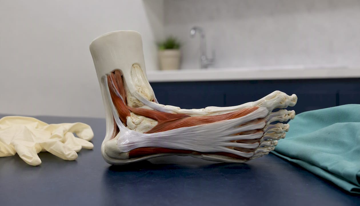 Foot model showing plantar fascia anatomy