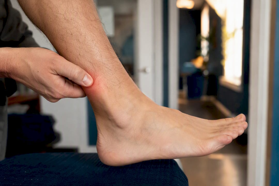 Hand touching achilles tendon area showing pain