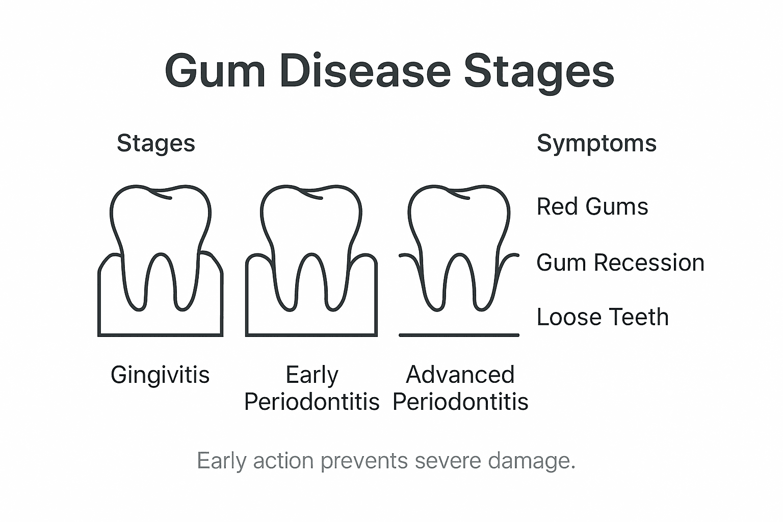 Infographic of gum disease stages with symptoms