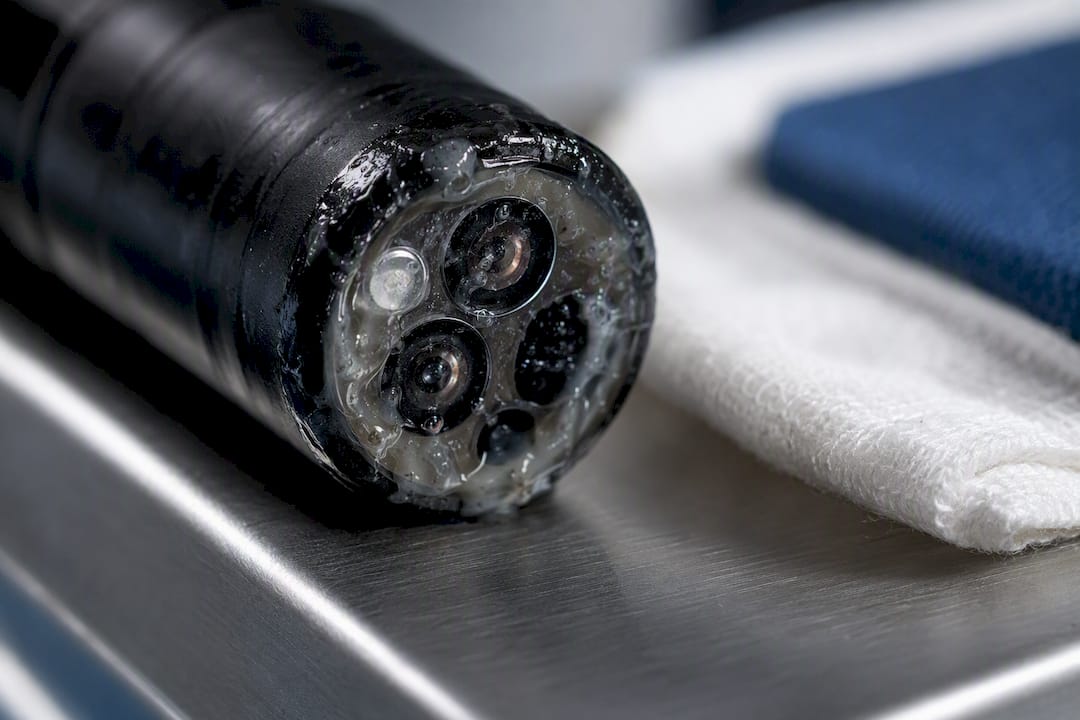 Condensation and residue obscuring endoscope lens