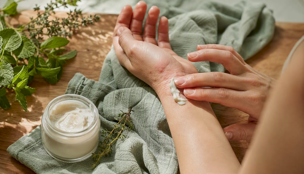 Applying natural lotion to irritated skin