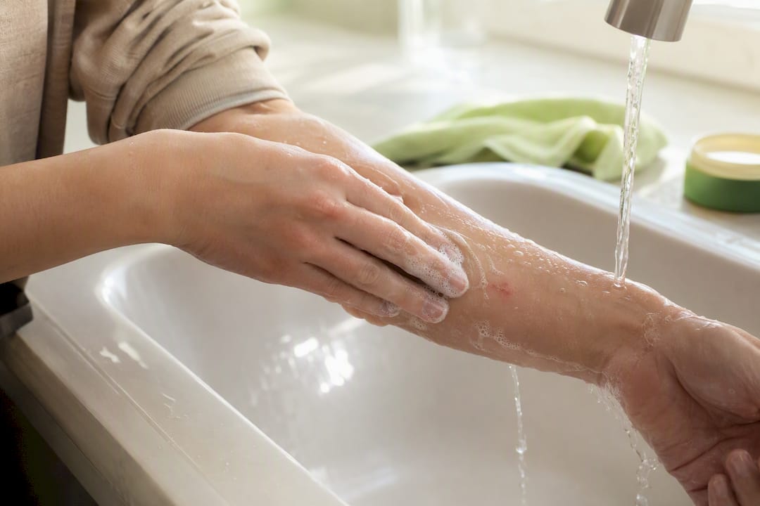 Forearm being washed with soap and water