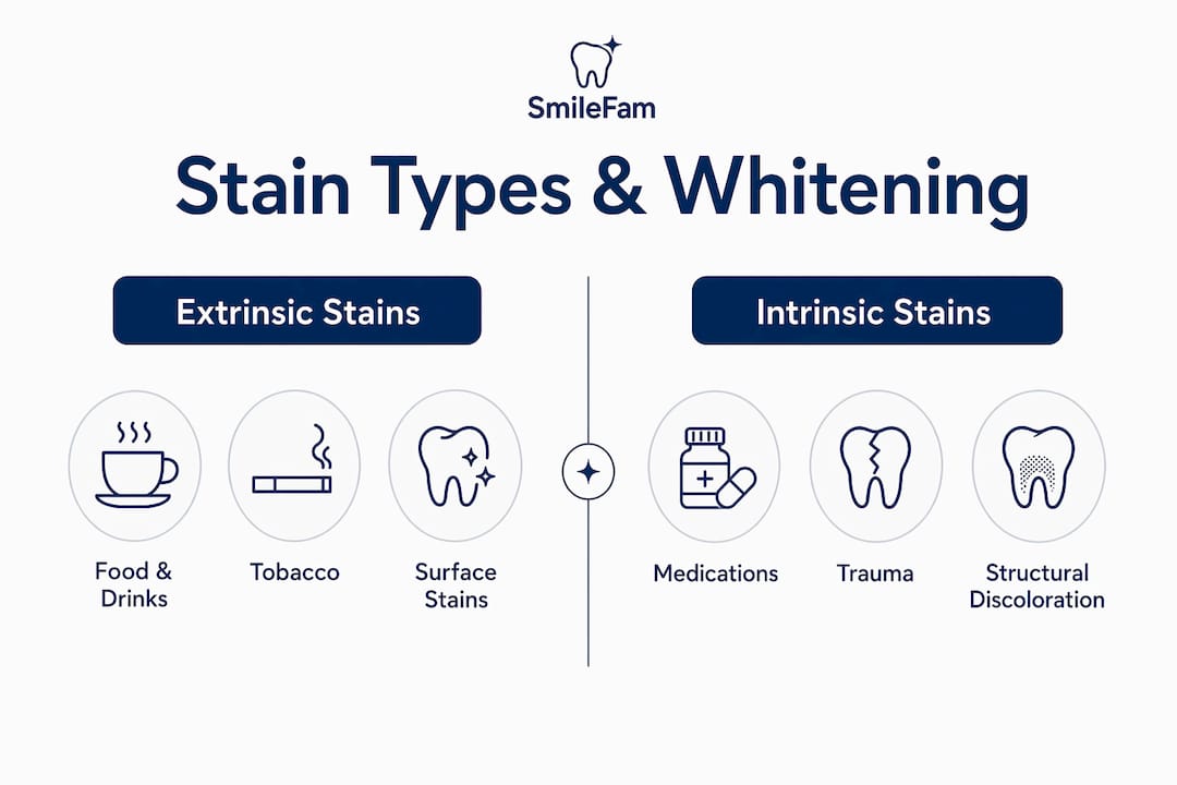Infographic comparing extrinsic and intrinsic teeth stains