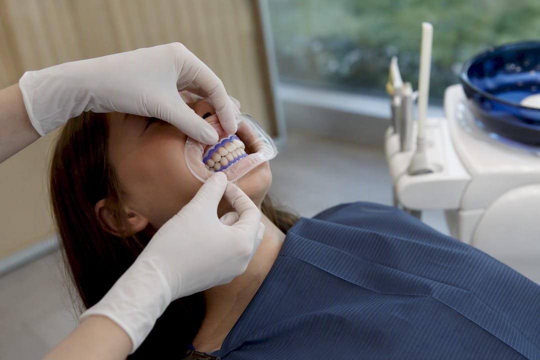 Hands placing dental gum barrier