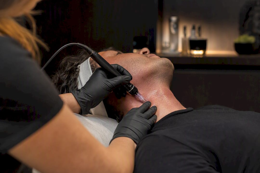 Microneedling treatment on male neck