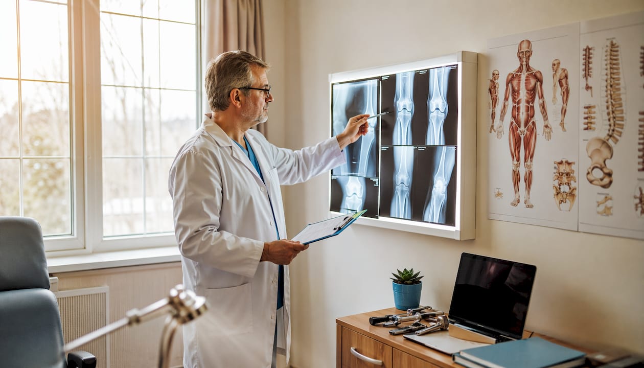 Medicul ortoped analizează radiografiile pentru a stabili diagnosticul.