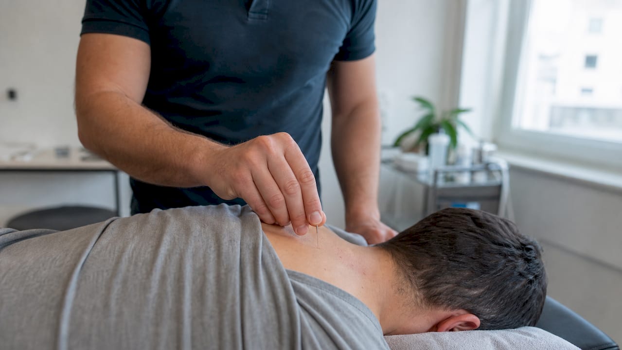 Close-up van dry needling spiertherapie