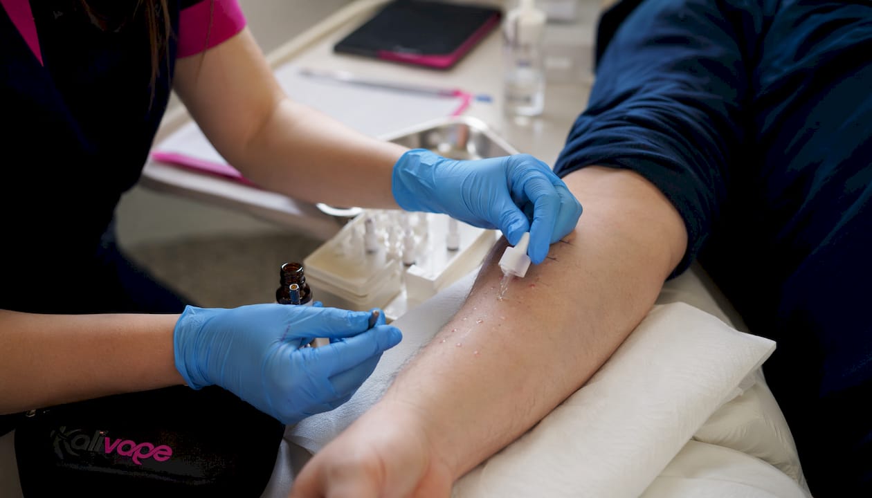 Un operatore esegue il prick test sul braccio di un paziente.