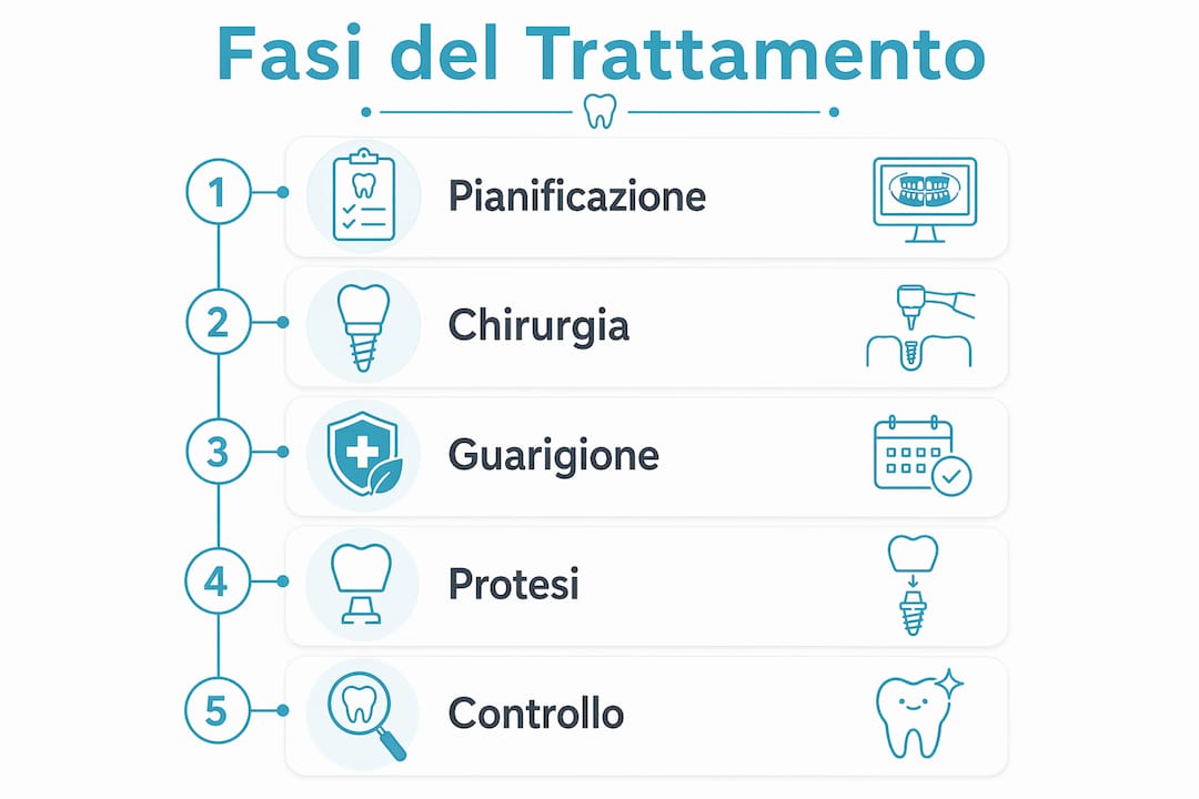 Schema grafico verticale che illustra passo dopo passo le diverse fasi del trattamento odontoiatrico