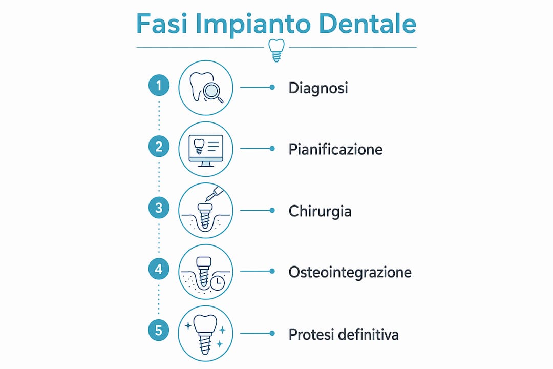 Scopri, attraverso un'infografica chiara e dettagliata, tutte le principali tappe dell’intervento di implantologia dentale.