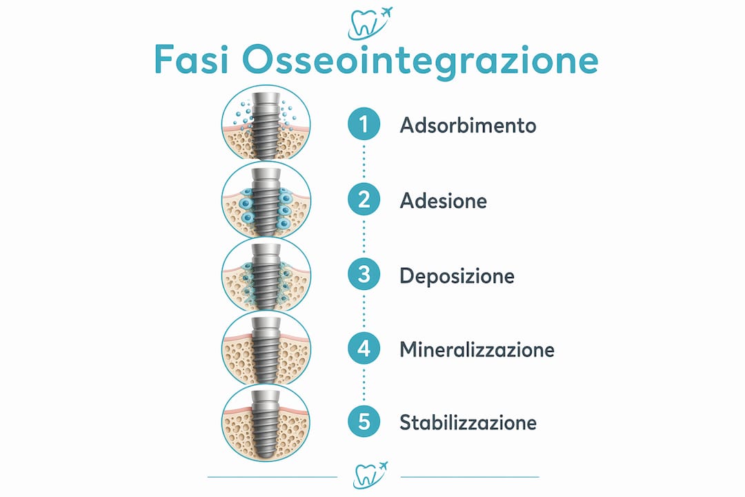 Schema illustrativo delle diverse fasi dell’osseointegrazione