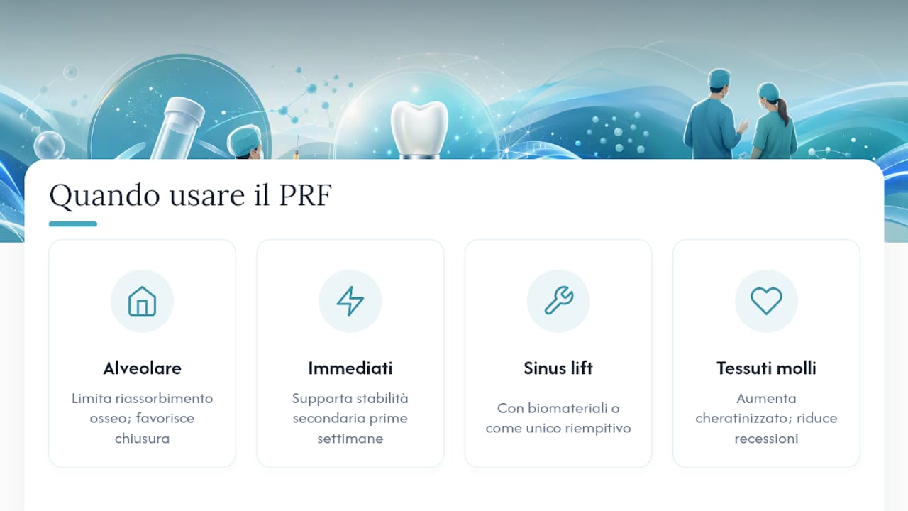 Quando si usa il PRF durante un intervento implantare? — overview diagram