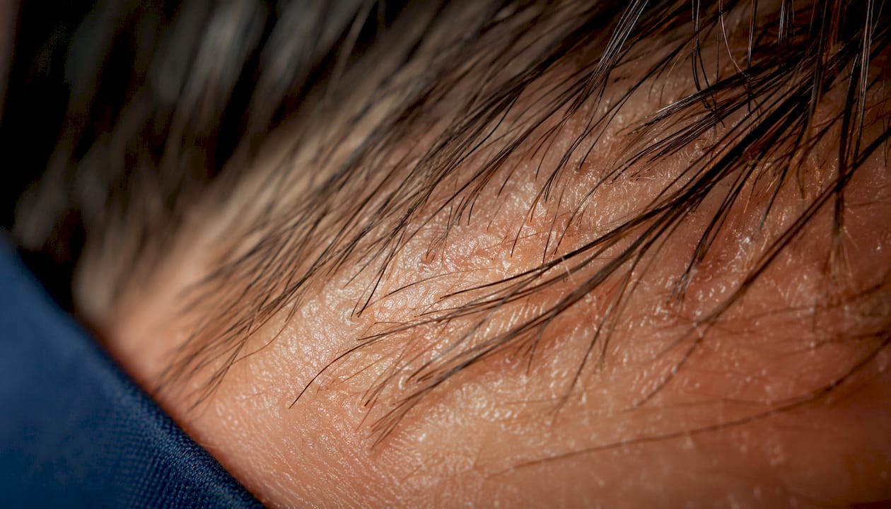 Close-up of hair follicles under microscope