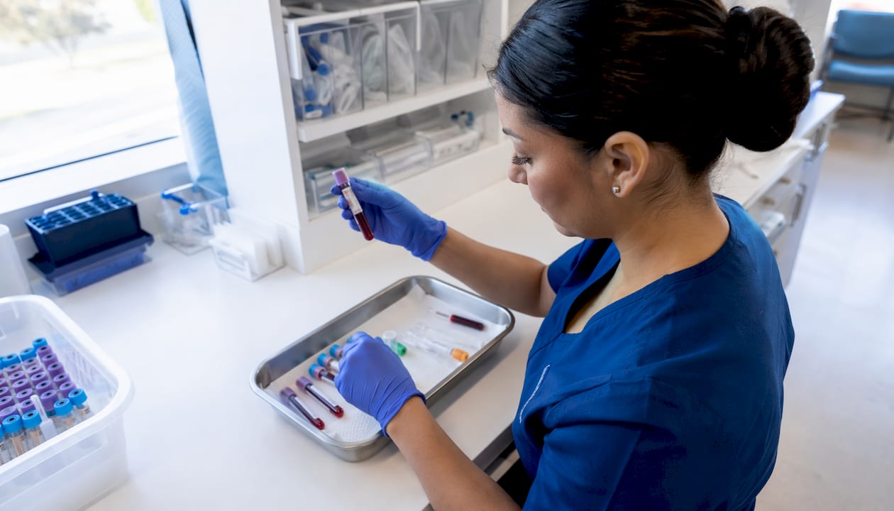 Technician preparing vitamin D blood sample