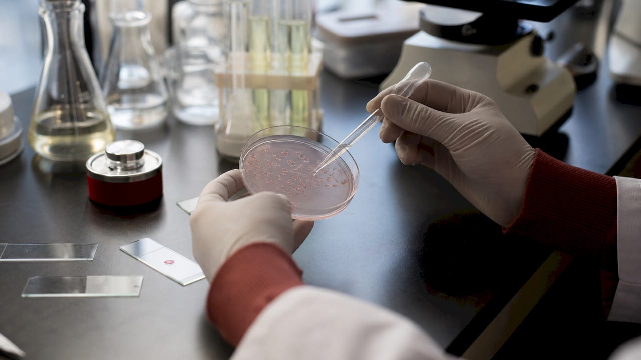 Hands handling petri dish with cultured skin cells