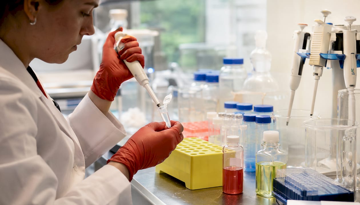 Hands preparing mitochondrial ROS samples in lab