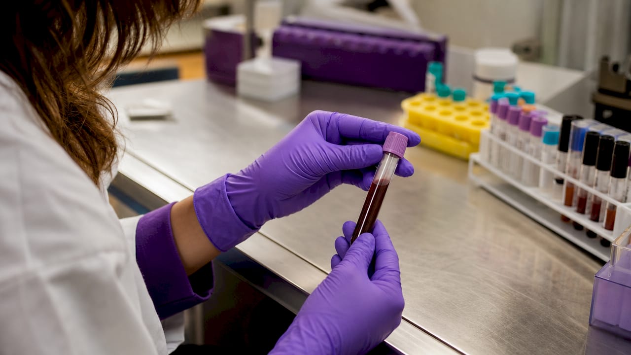 Hands holding blood test tube in lab