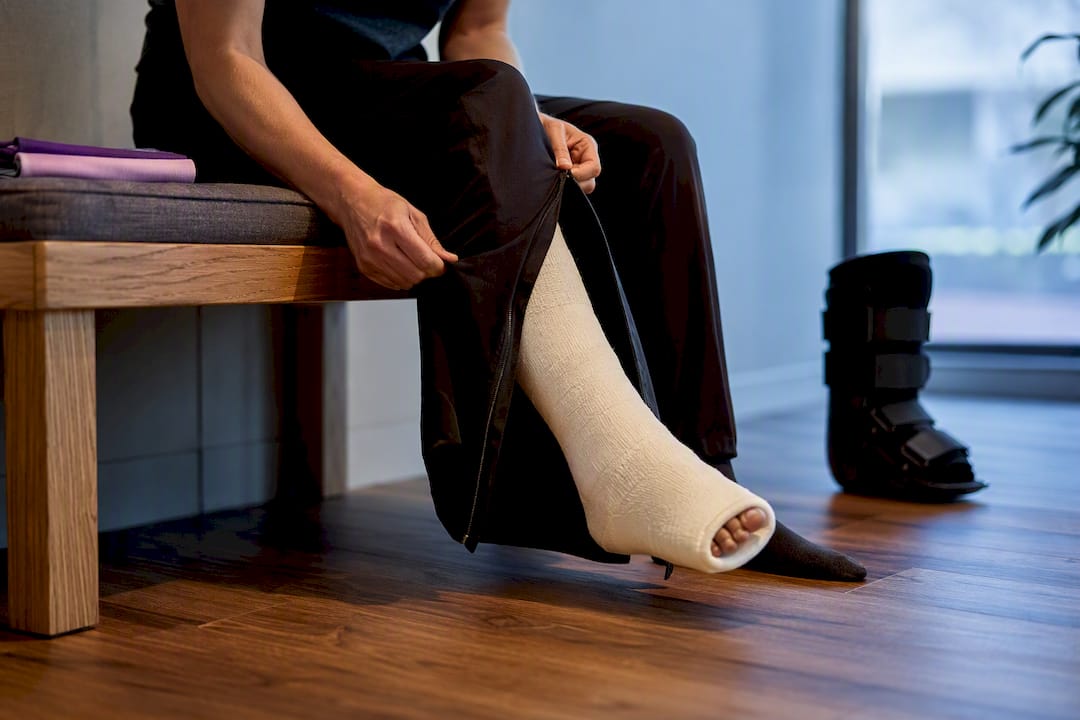 Person dressing around a broken ankle cast