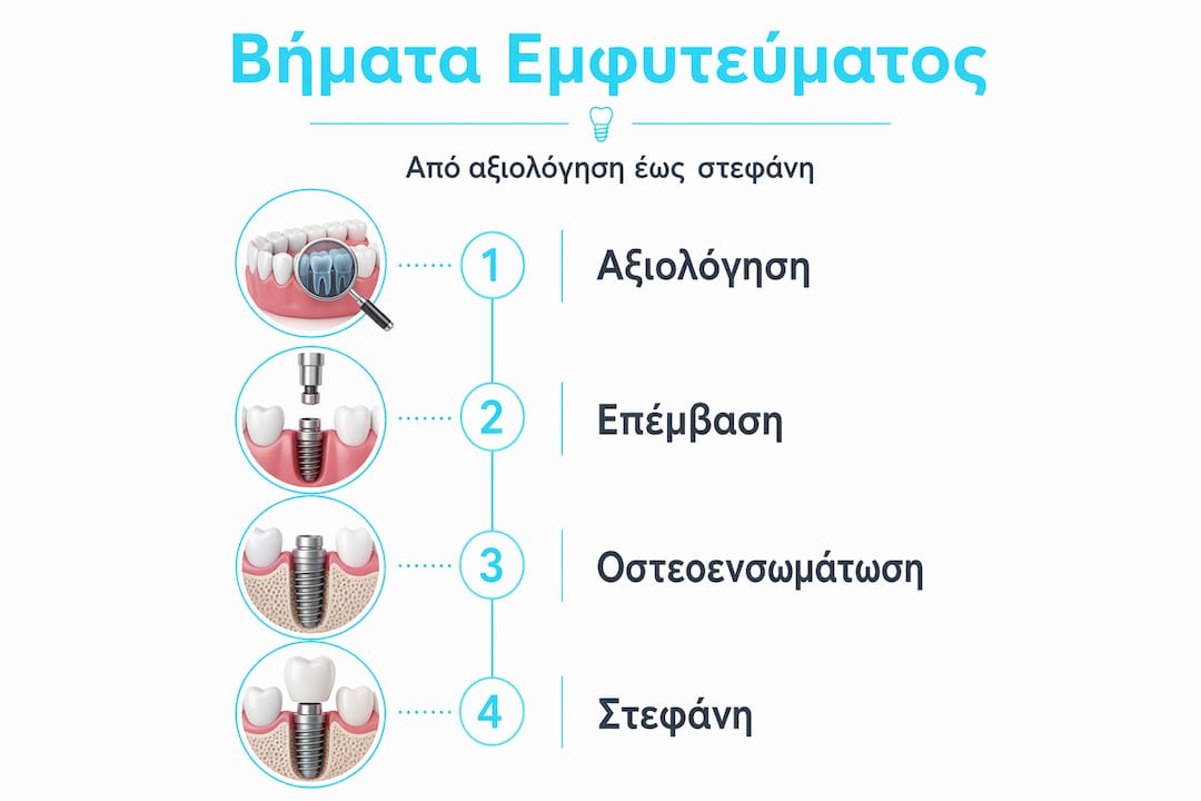 Ενδεικτική σειρά βημάτων για την τοποθέτηση εμφυτεύματος