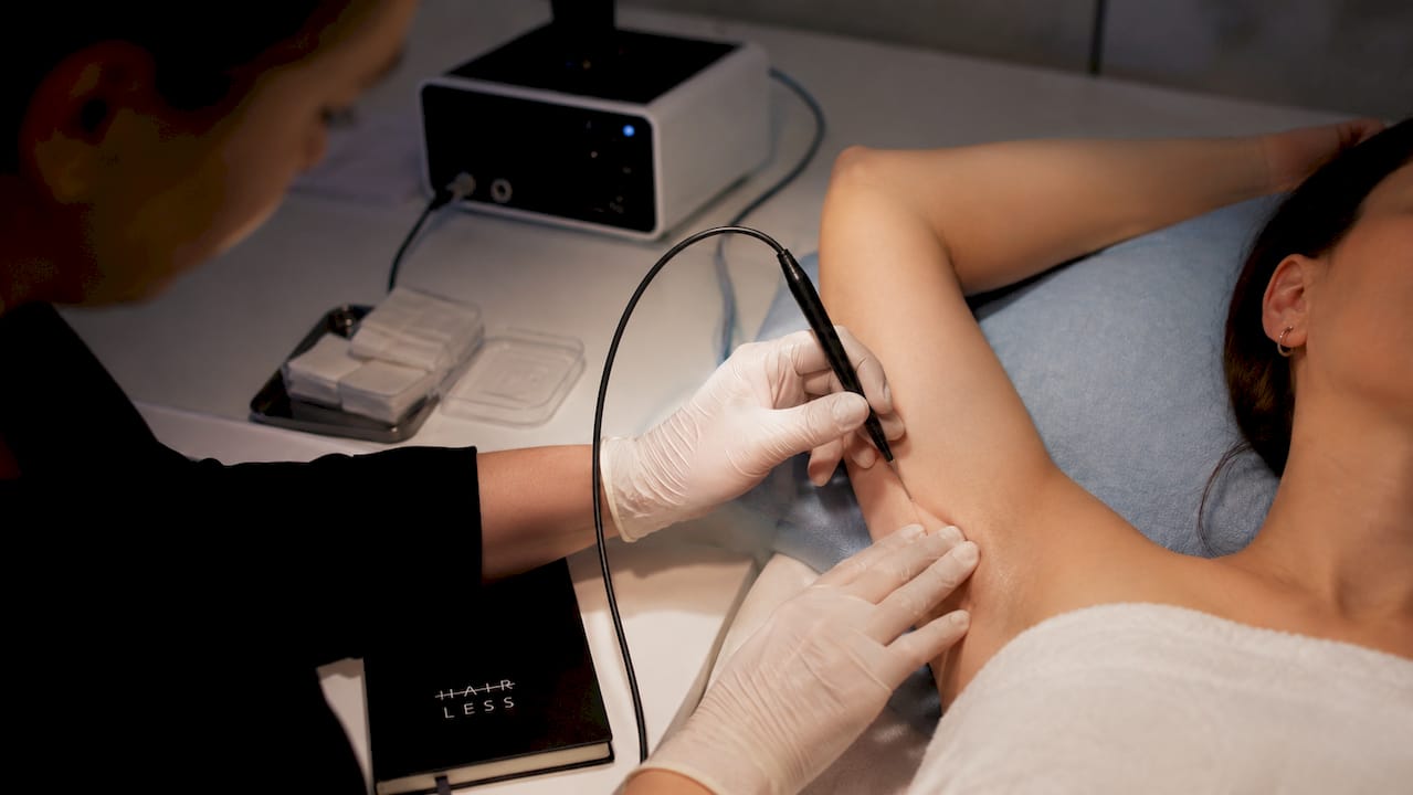 Detailný záber na galvanickú elektrolytickú procedúru v oblasti podpazušia.