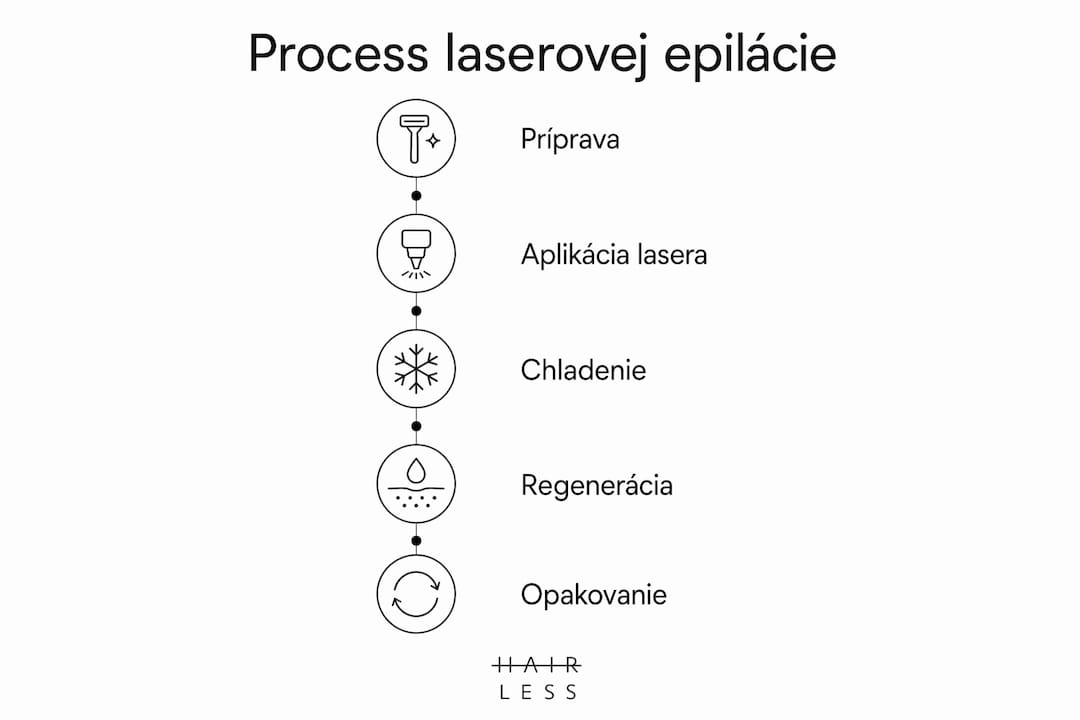Prehľadný grafický návod, ako prebieha laserové odstránenie chĺpkov