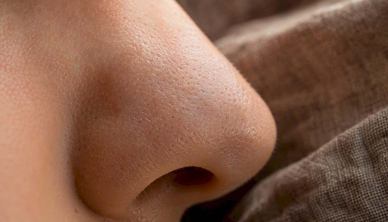 Close-up of skin pores with sebaceous filaments