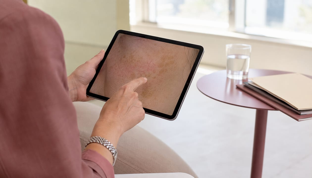 Hands holding tablet with dermoscopic facial skin image