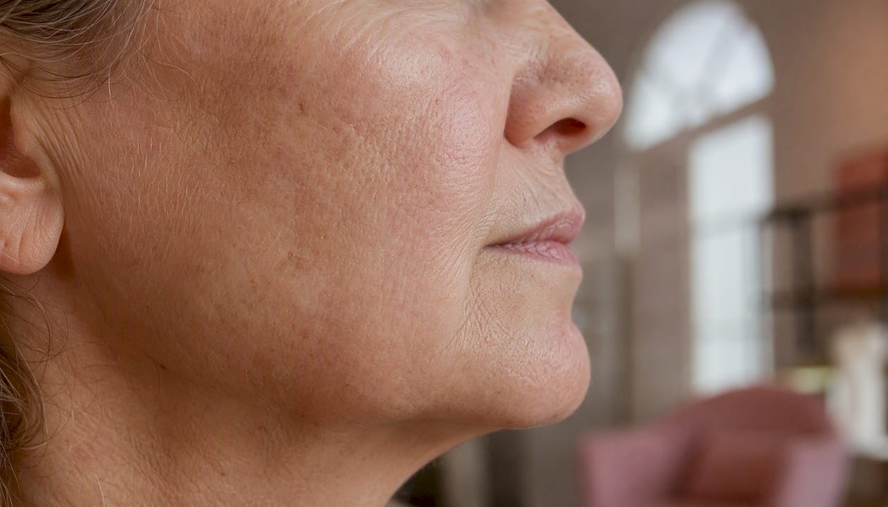 Close-up of aging skin texture and fine lines