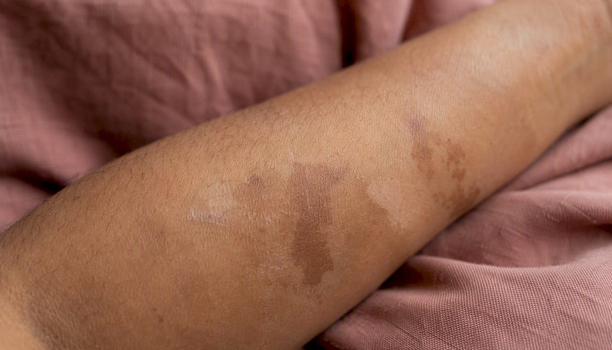 Close-up skin showing pigmentation variations