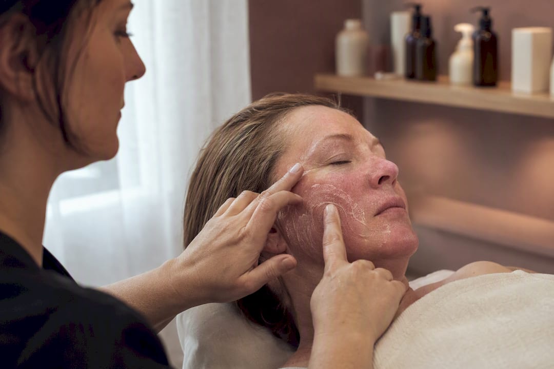 Clinician applying gentle peel to rosacea skin