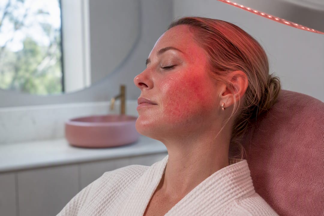Woman receiving red light therapy for rosacea