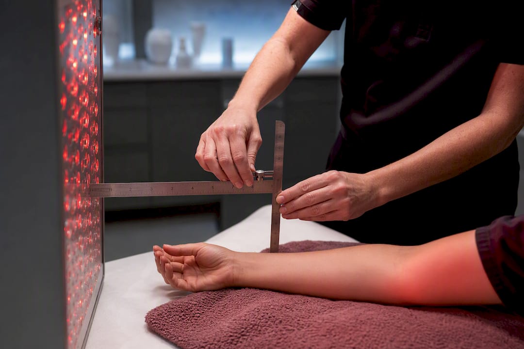 Clinician measuring supervised light therapy dose
