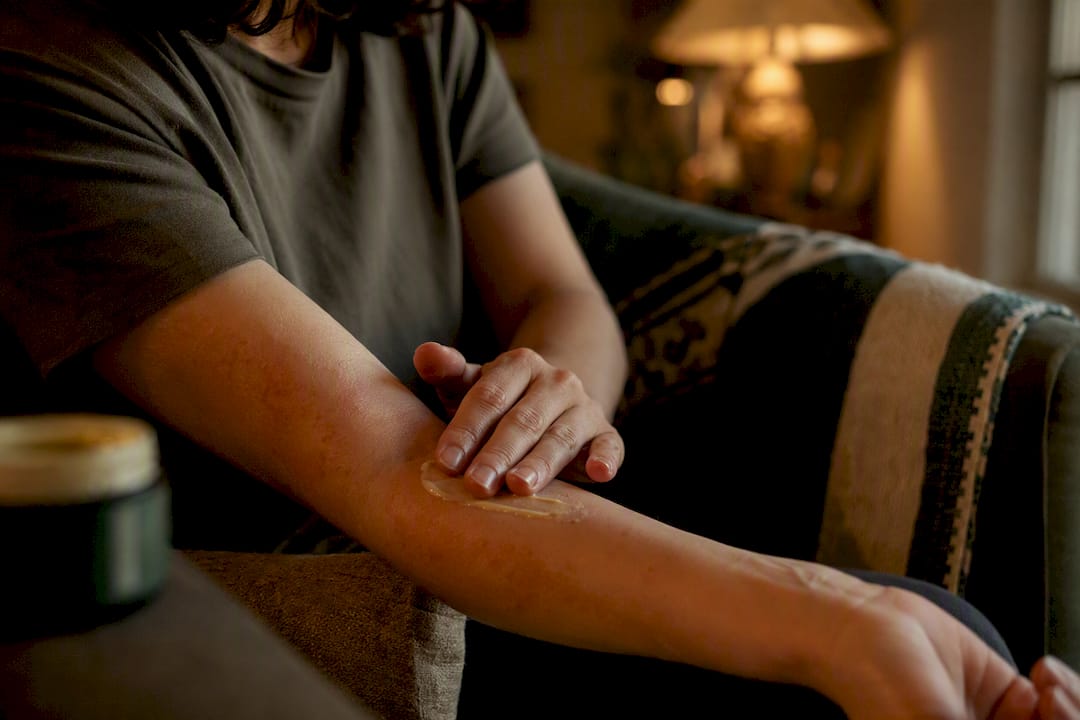 Person applying balm to eczema-prone forearm