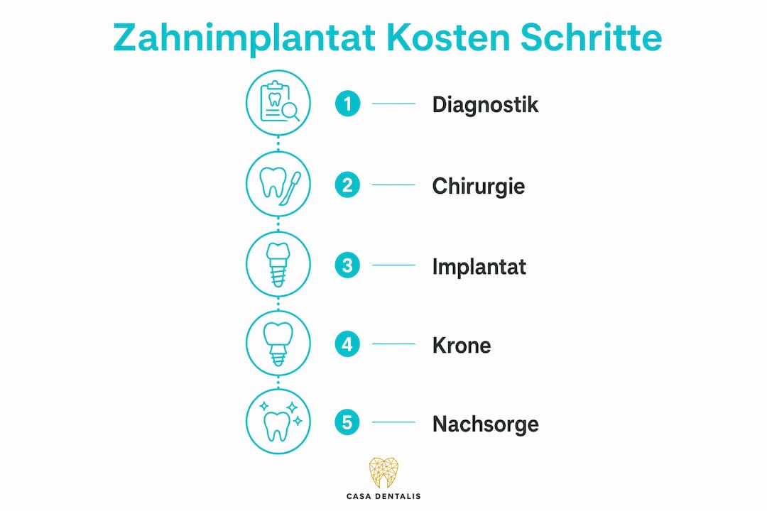 Übersicht: Die einzelnen Kostenfaktoren bei Zahnimplantaten im Überblick