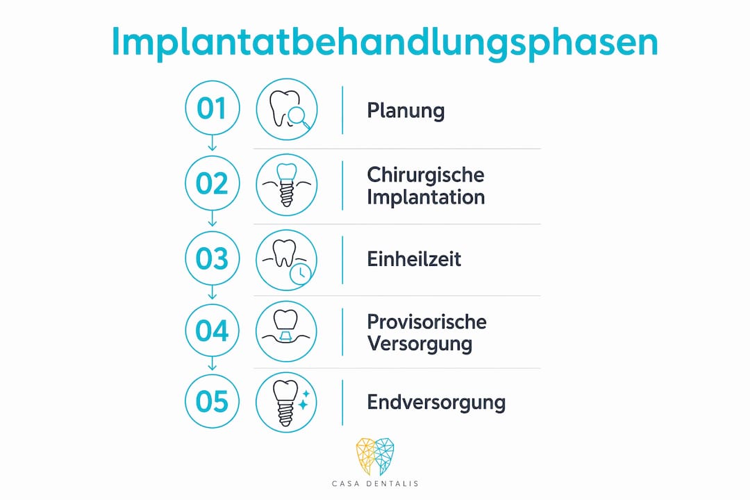 Grafische Übersicht der einzelnen Schritte einer Implantatbehandlung – von der ersten Planung bis hin zur finalen Versorgung.
