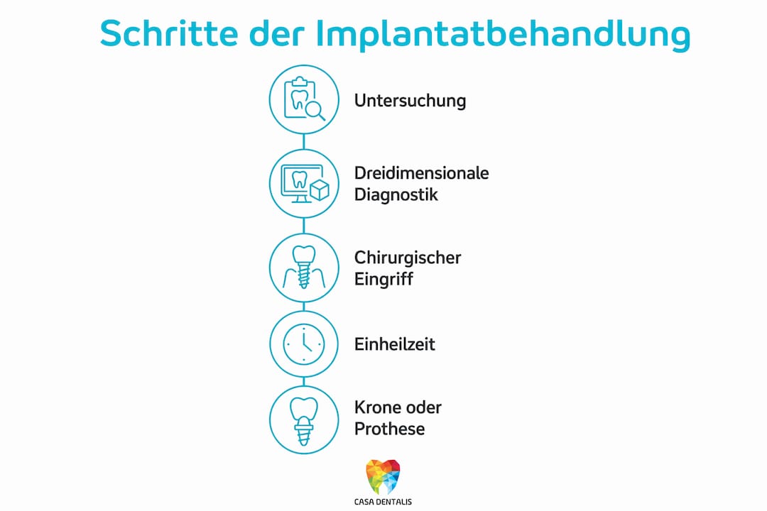 Übersichtsgrafik: Die einzelnen Schritte einer Implantatbehandlung auf einen Blick