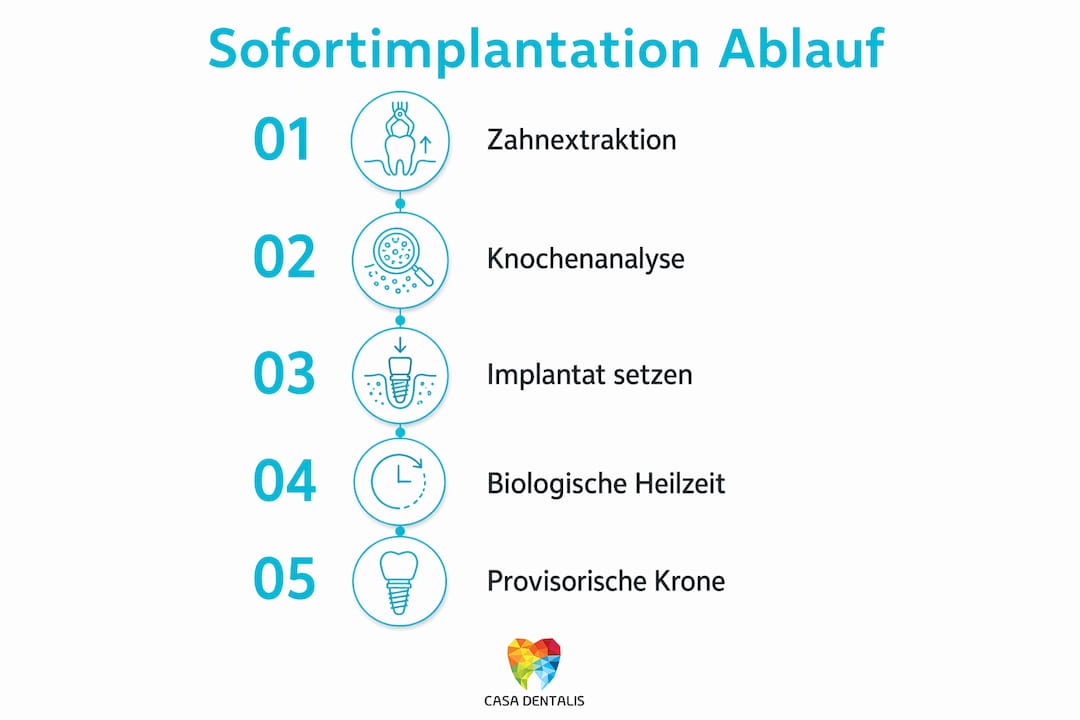 Schritt-für-Schritt-Anleitung zur Sofortimplantation – der Ablauf im Überblick