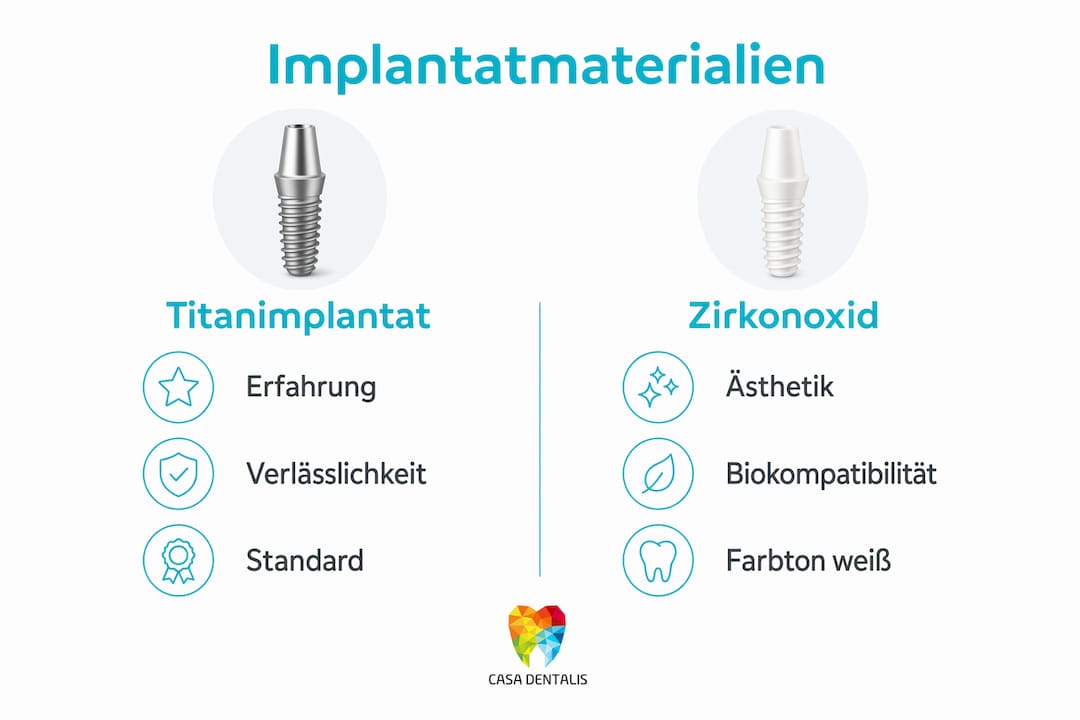 Infografik: Titan-Implantate und Zirkonoxid-Implantate im direkten Vergleich