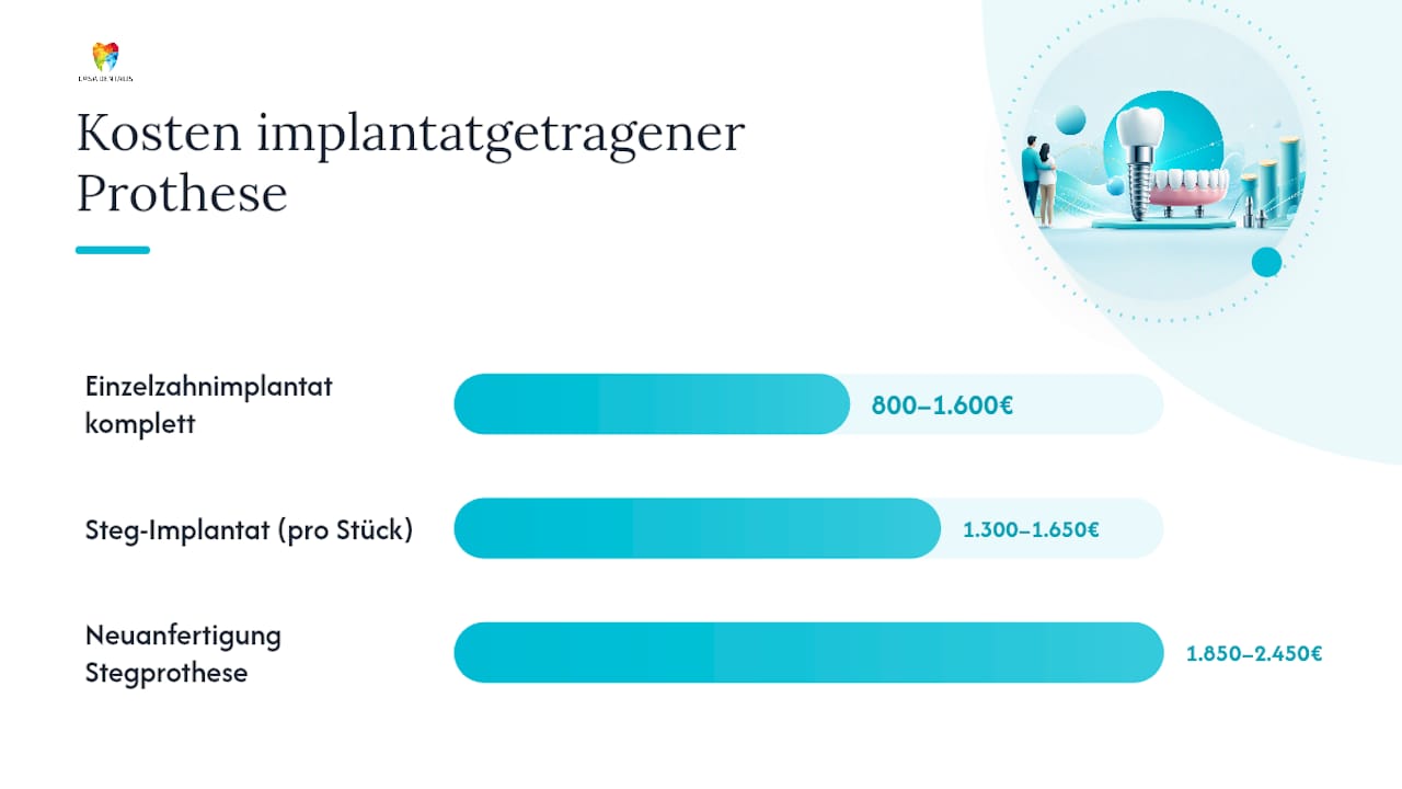 Was kostet eine implantatgetragene Prothese? — overview diagram