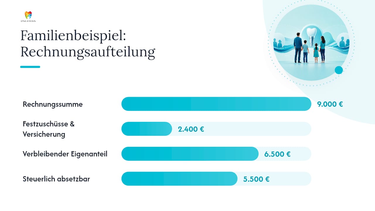 So berechnet man den Steuerabzug vom Implantatpreis