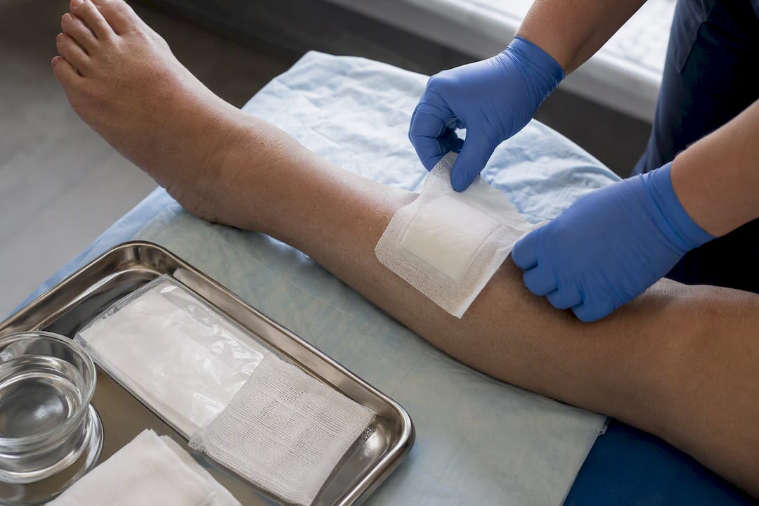 Clinician applying dressing during wound care